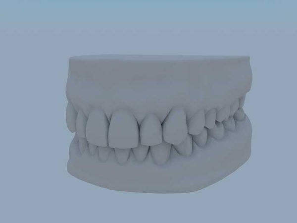دانلود مدل سه بعدی دندان